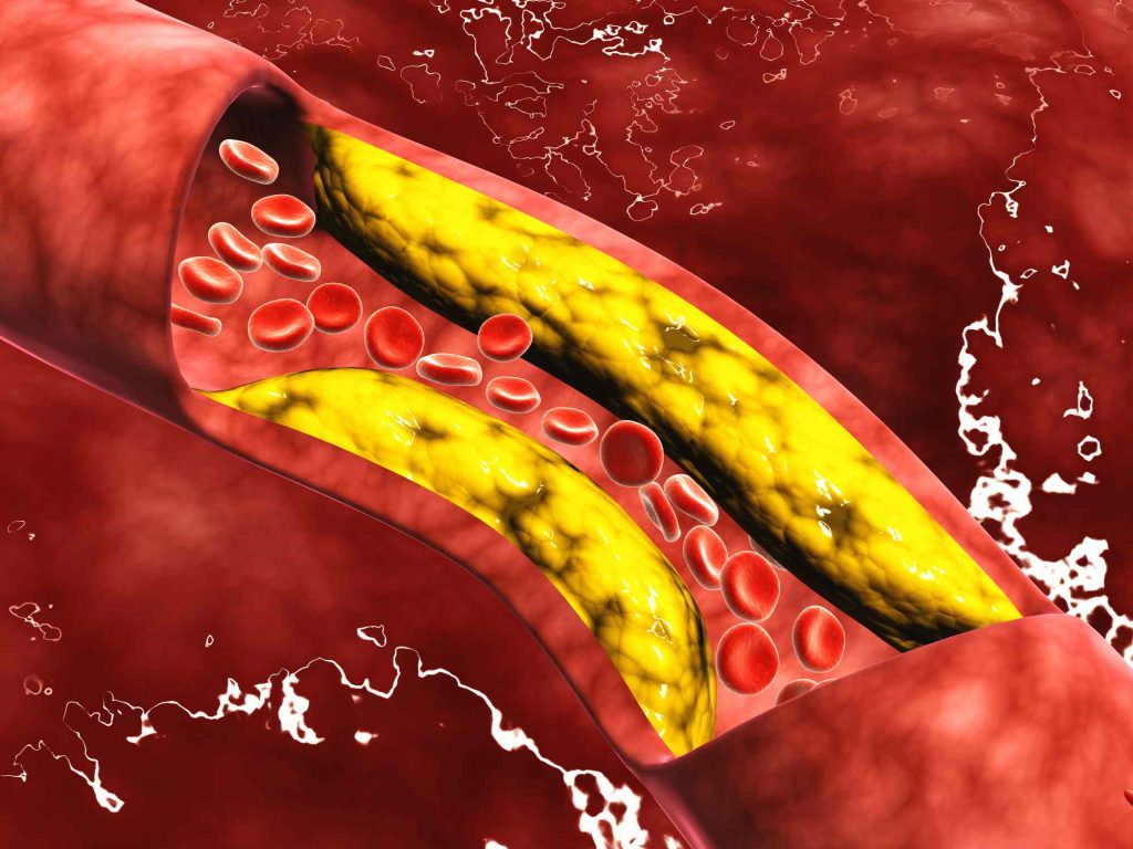 Tác dụng của Vitamin B3 - làm giảm Cholesterol trong máu