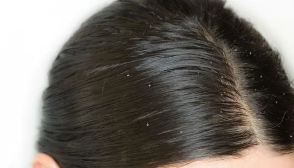 Mách bạn 5 mẹo hair care “say bye” tóc bết hiệu quả: Kéo đến cuối để