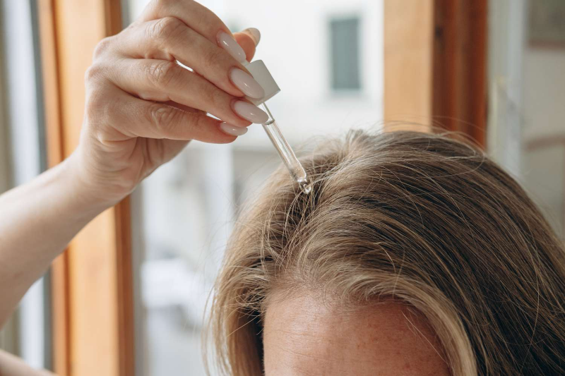 Một số điều cần quan tâm khi trị tình trạng gàu tại nhà