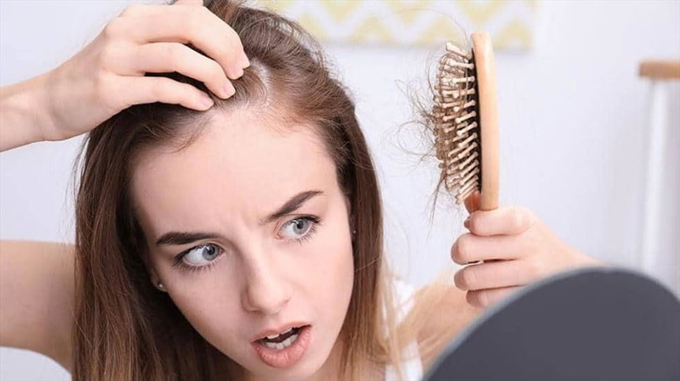Rụng tóc nhiều ở nữ là thiếu chất gì?