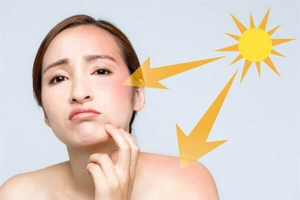 Kích thích sản sinh collagen hiệu quả bằng cách bảo vệ da khỏi tia UV