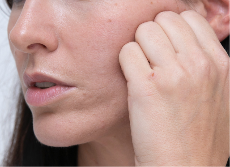 Da chảy xệ, nhiều vết nhăn