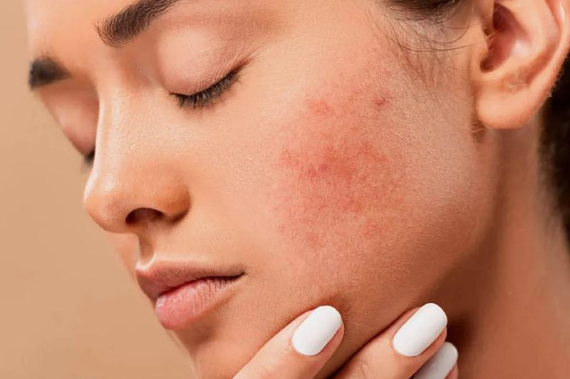 Do tác động của ánh nắng mặt trời