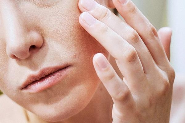 Da quá khô phải làm sao? Nguyên nhân và cách giải quyết 2 Dấu hiệu khi da bị khô