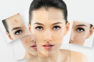 Nên lựa chọn loại collagen nào để bổ xung cho cơ thể