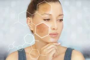 cach ngan ngua nam da hieu qua