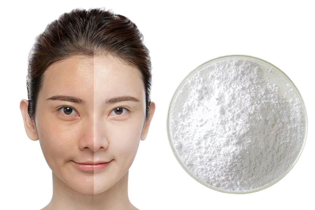 can glutathione treat melasma Frontiers