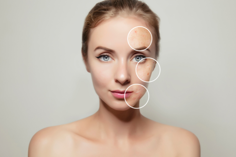 Uống Collagen Có Tác Dụng Không? 10 Sai Lầm Thường Gặp 4 Bổ sung collagen giúp cải thiện lão hóa da