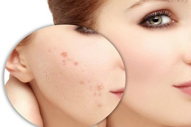 Phục Hồi Collagen: Nên Uống Gì, Bôi Kem Gì Hiệu Quả? 3 Tại sao cần phục hồi collagen?