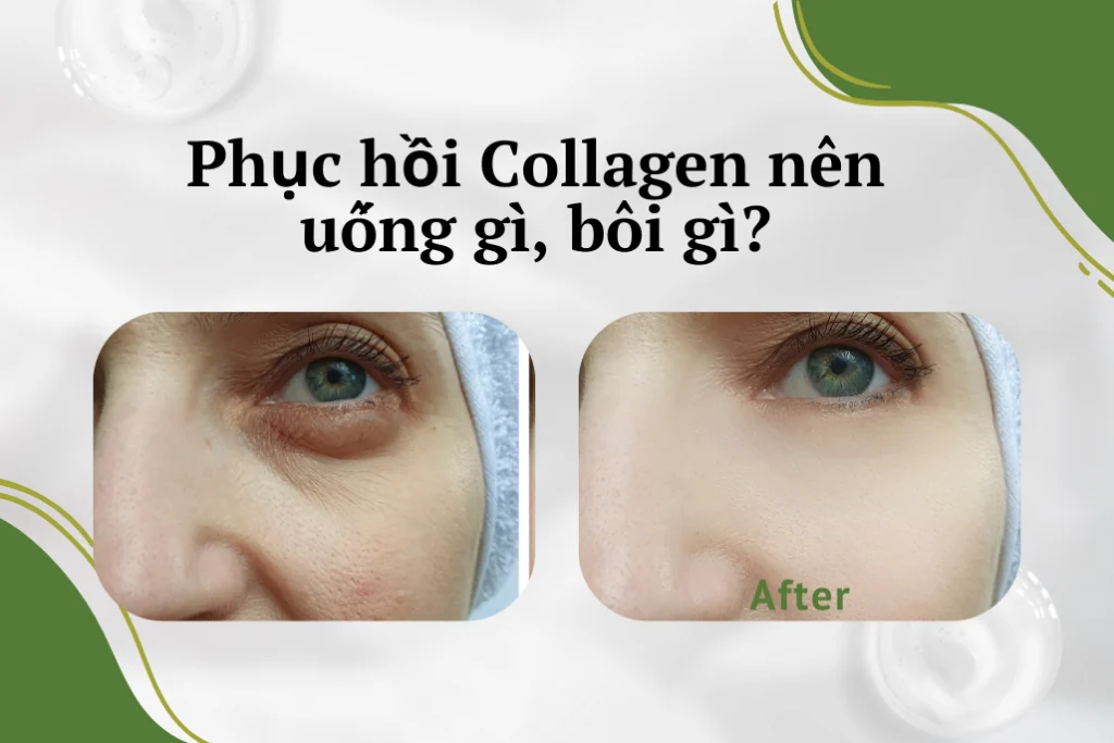 Phục Hồi Collagen: Nên Uống Gì, Bôi Kem Gì Hiệu Quả? Phục Hồi Collagen: Nên Uống Gì, Bôi Kem Gì Hiệu Quả?