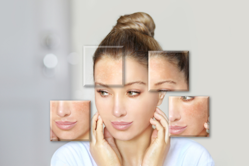 Da mất nước, xỉn màu và kém đàn hồi