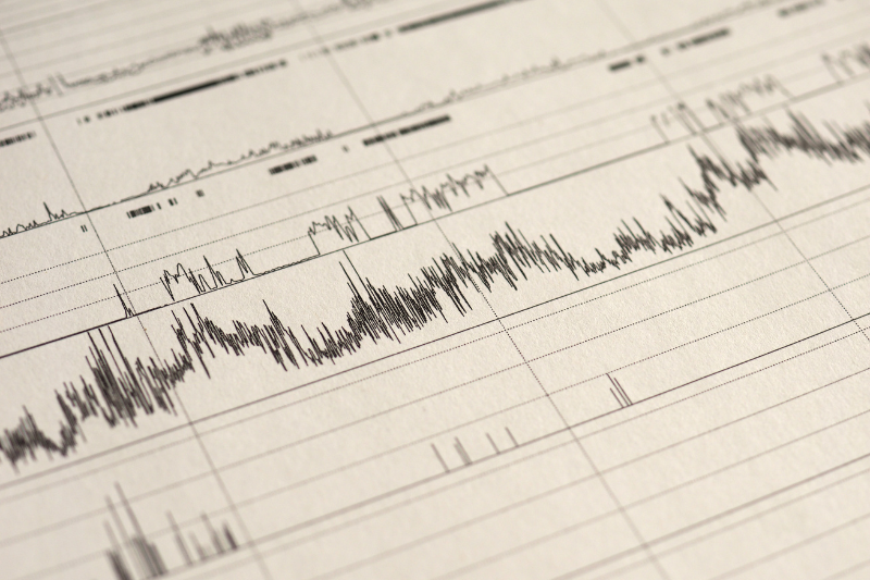 Có nên dùng thiết bị đeo theo dõi giấc ngủ không? 6 Mức độ chính xác không cao
