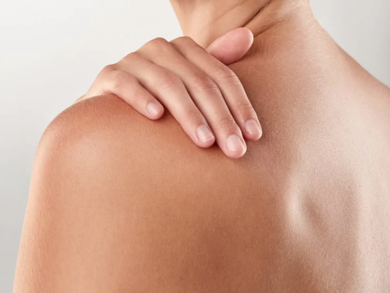 Tổng Hợp 8 Viên Uống Trị Mụn Đẹp Da Hiệu Quả Nhất 4 Viên uống trị mụn giúp hỗ trợ nuôi dưỡng làn da từ trong ra ngoài