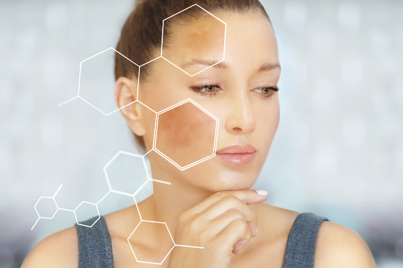 Người bị nám hoặc sạm da nên uống glutathione Nhật