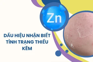 Dấu hiệu nhận biết tình trạng thiếu kẽm, tác hại và cách bổ sung đúng