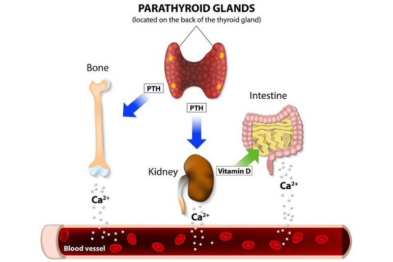 Những dấu hiệu và tác hại khi bổ sung thừa vitamin D 3 Thừa vitamin D tăng canxi máu