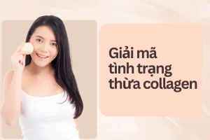 Giải mã tình trạng thừa collagen cùng cách bổ sung tránh gặp phải tình trạng này