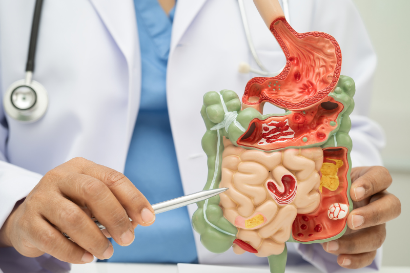 Rối loạn tiêu hóa do dư thừa vitamin C