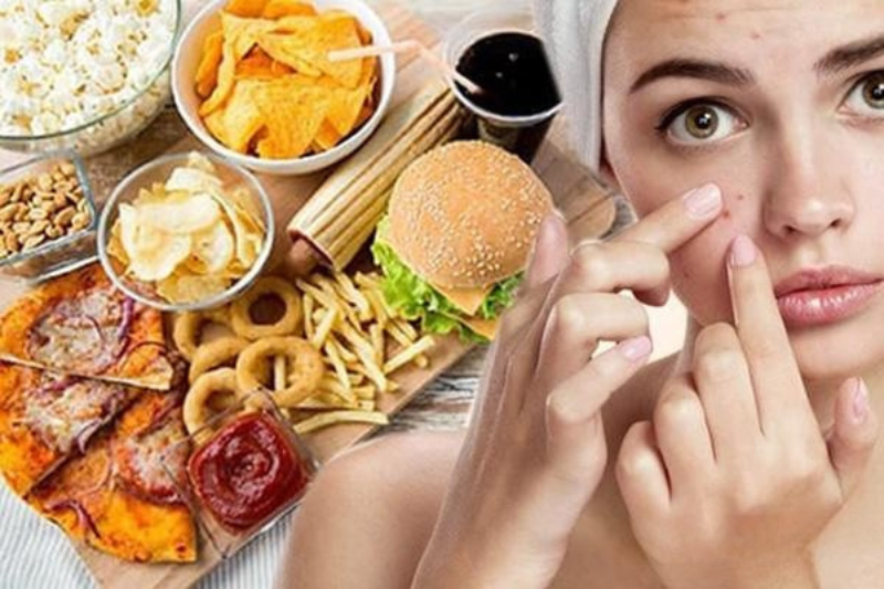 Vì Sao Uống Vitamin C Bị Nổi Mụn Và Cách Xử Lý Hiệu Quả 6 Tránh các thực phẩm cay, chiên, nhiều đường để mụn không trở lại