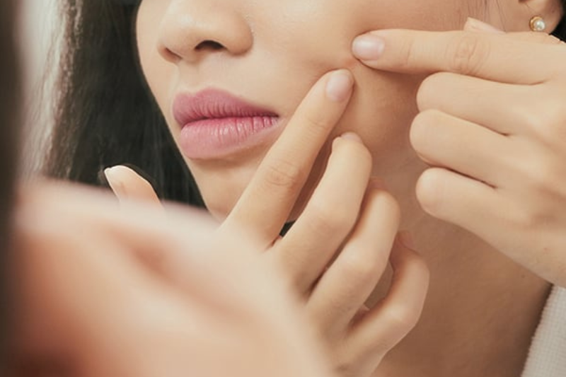 Vì Sao Uống Vitamin C Bị Nổi Mụn Và Cách Xử Lý Hiệu Quả 2 Uống vitamin C bị nổi mụn là do dùng liều cao đột ngột, gây kích ứng nhẹ