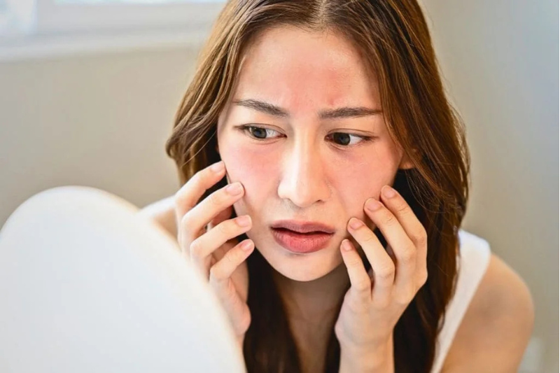 Vitamin C nồng độ cao khiến da bị kích ứng, mỏng, nhạy cảm hơn