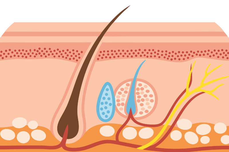 Tuyến bã nhờn hoạt động mạnh mẽ làm tăng nguy cơ gây mụn