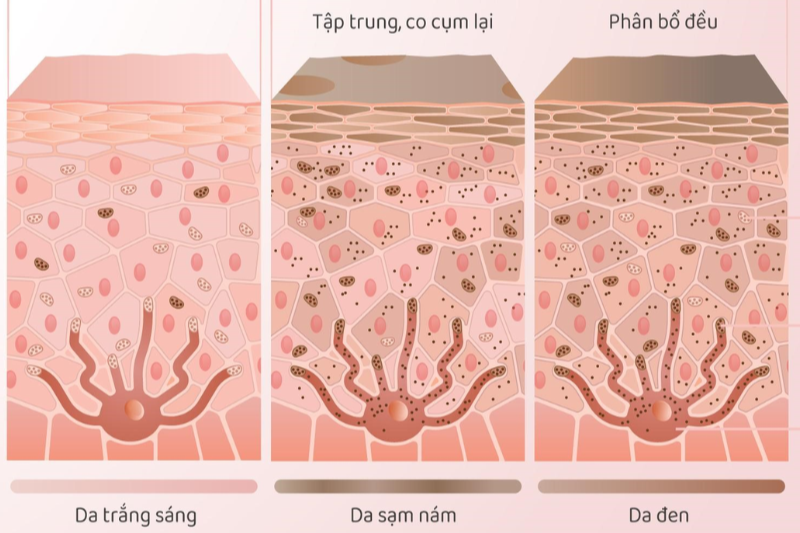 Vitamin C giúp ức chế hắc sắc tố melanin