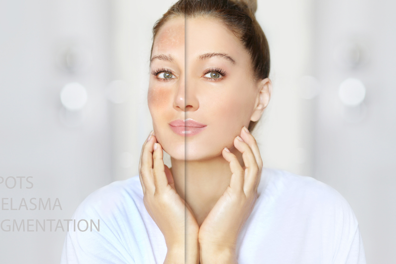 Vitamin C kích thích tái tạo mô da