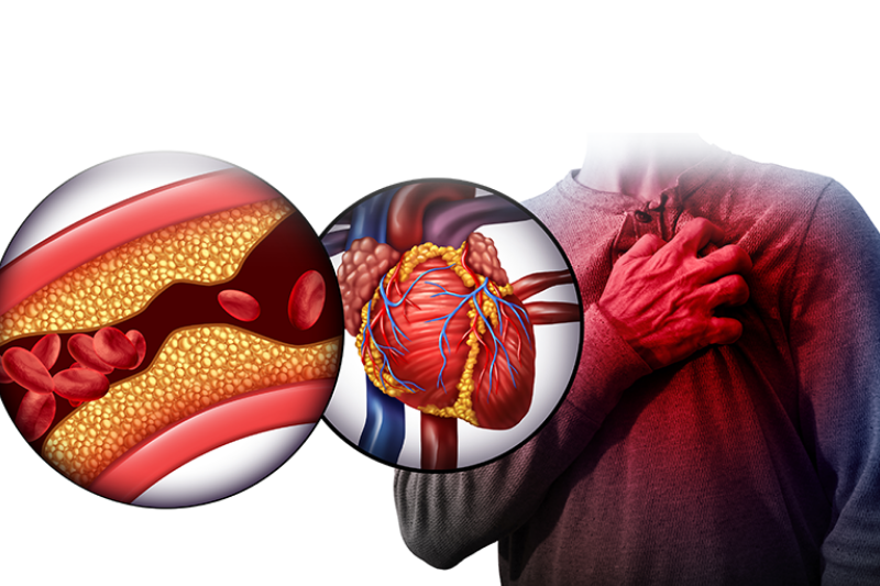 Thiếu omega 3 kéo dài ảnh hưởng tới sức khỏe tim mạch và mỡ máu