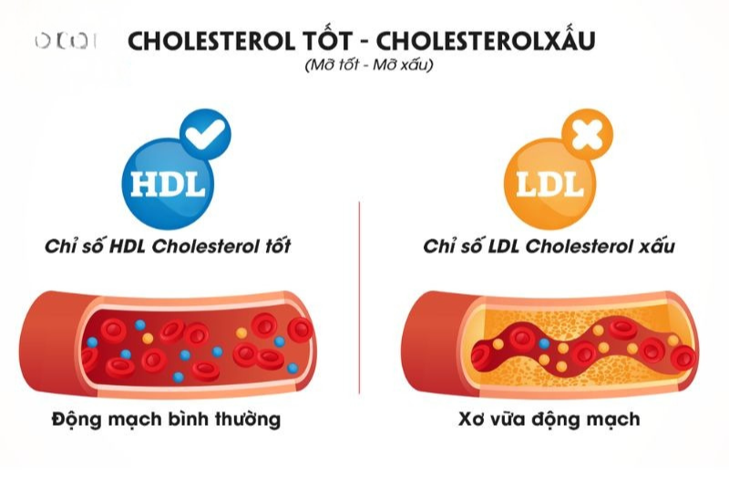 Omega 3 giúp cân bằng cholesterol LDL và HDL