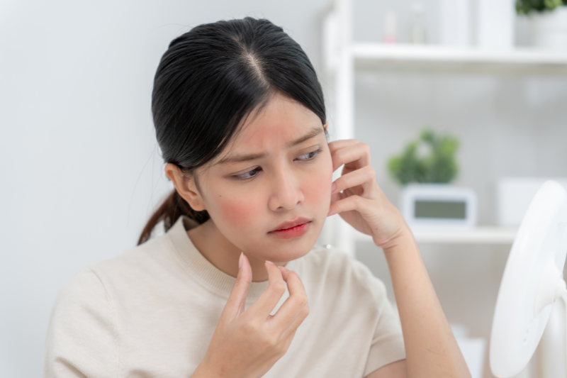 Omega 3 góp phần làm dịu da, điều hòa viêm