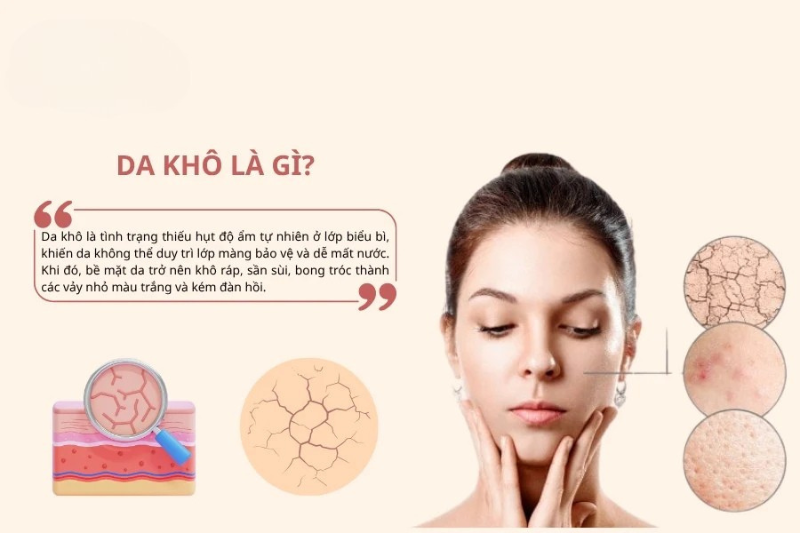 Da khô cần chú trọng được cấp ẩm đúng cách