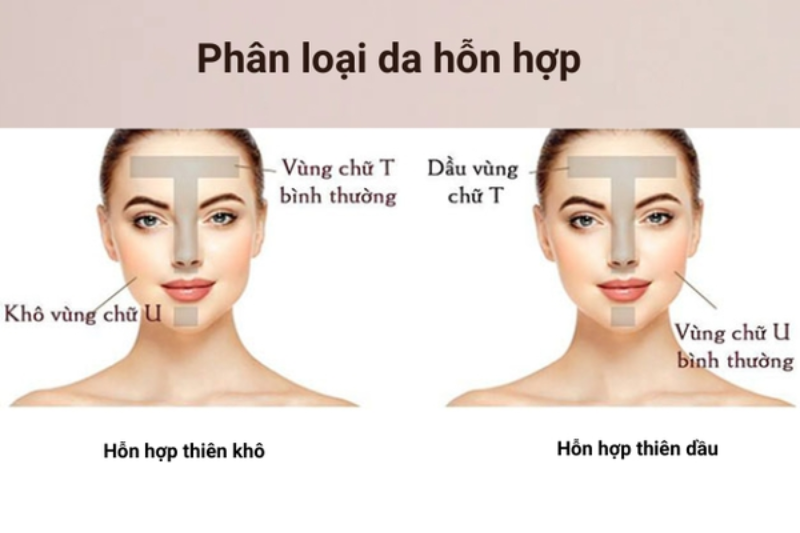Da hỗn hợp nên chọn sản phẩm phù hợp cho từng vùng