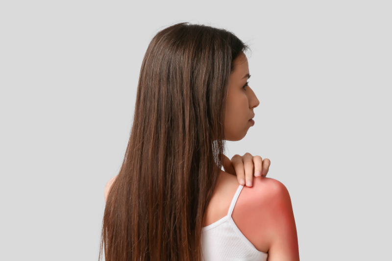 Tia UV có thể khiến da xỉn màu do tăng sinh melanin