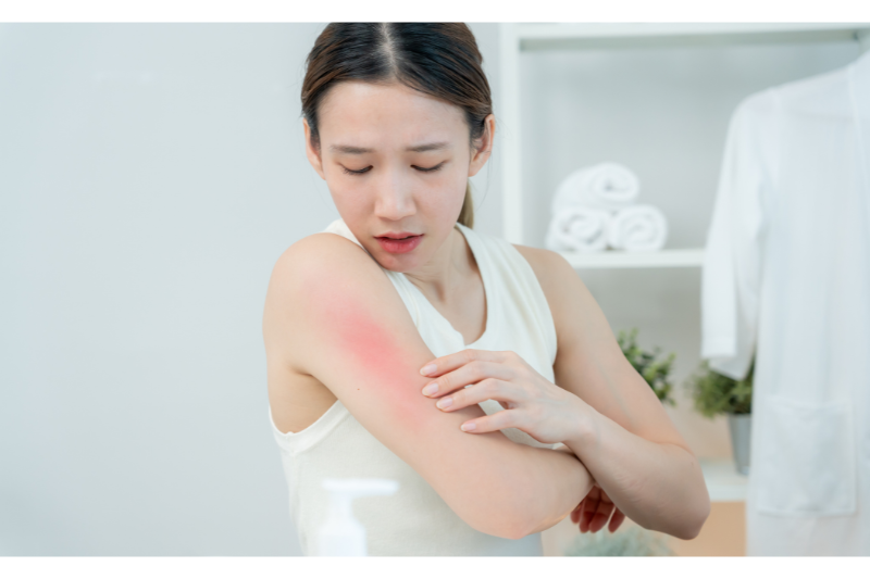 Da cũng dễ kích ứng hơn nếu thường xuyên tiếp xúc với ánh nắng
