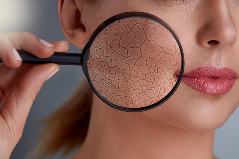 Hàng rào bảo vệ da là lớp bảo vệ làn da mỏng manh trước các tác nhân gây hại