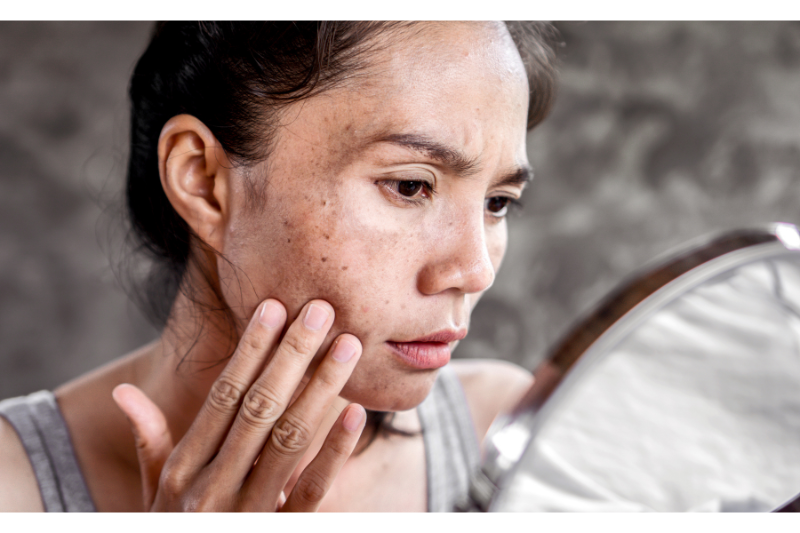 Da xỉn màu do hệ tiêu hóa kém khỏe mạnh