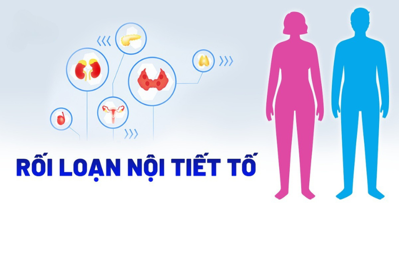 Tất tần tật các nguyên nhân gây mụn từ chuyên gia 3 Rối loạn nội tiết tố khiến tuyến bã nhờn hoạt động mạnh hơn