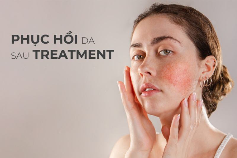 Tất tần tật các nguyên nhân gây mụn từ chuyên gia 8 Lạm dụng phương pháp treatment khi điều trị khiến mụn nặng hơn