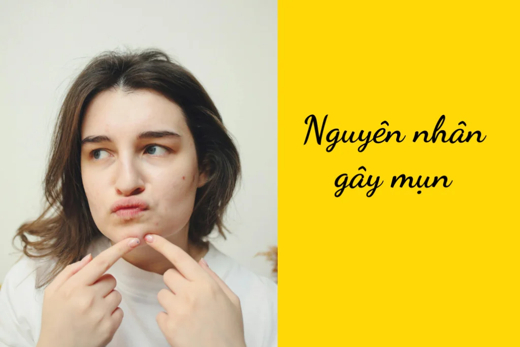 Tất tần tật các nguyên nhân gây mụn từ chuyên gia 1 Tất tần tật các nguyên nhân gây mụn từ chuyên gia