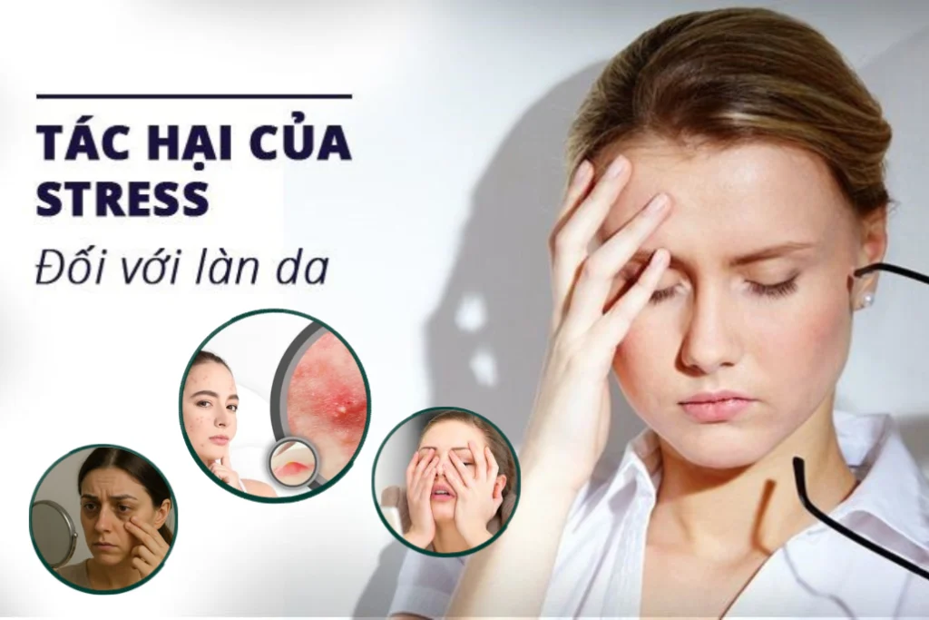 stress anh huong den da