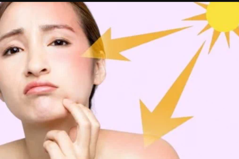 Tia UV là nguyên nhân khiến da mất độ đàn hồi và xuất hiện nếp nhăn