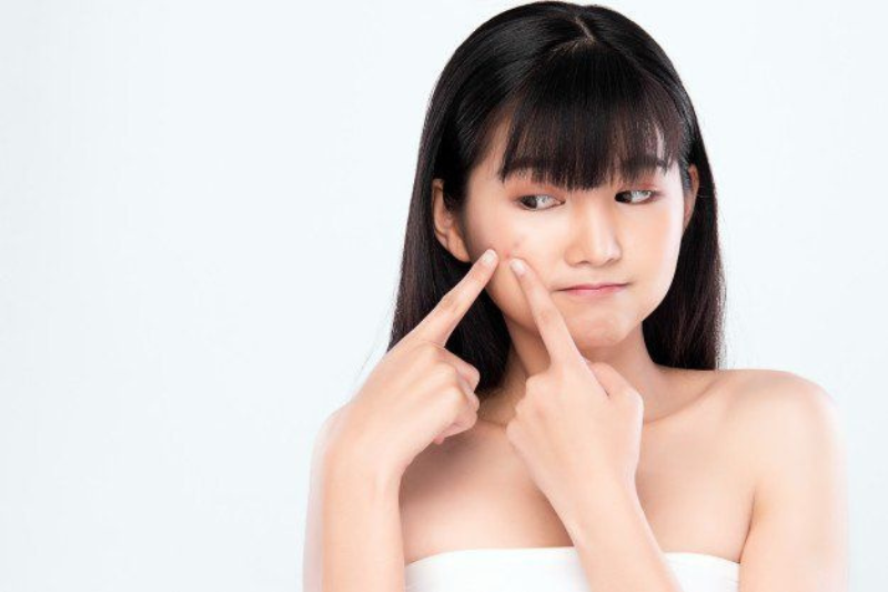 Tuổi dậy thì là lúc nội tiết tố thay đổi mạnh, khiến da dễ hình thành mụn trứng cá