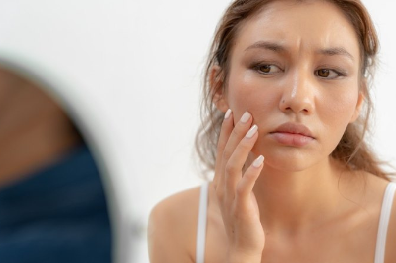 Da khô và da thiếu nước đều khiến làn da khô ráp, xỉn màu và kém sức sống