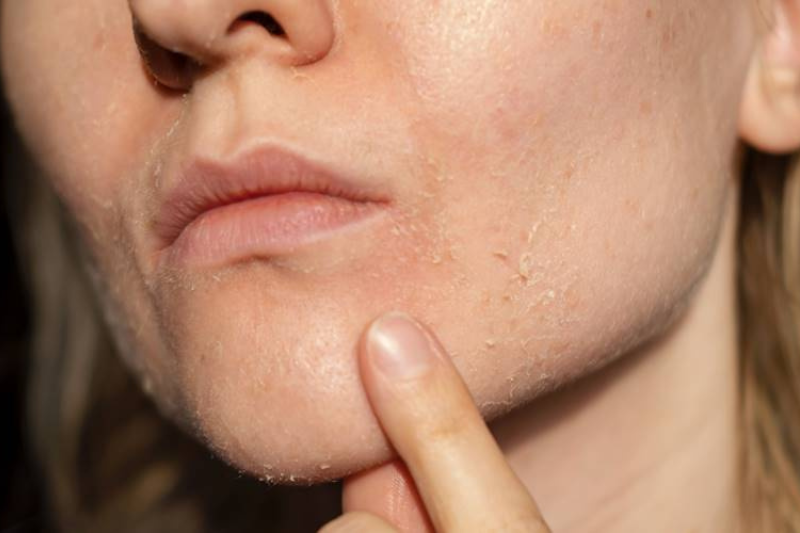 Dựa vào cảm giác trên bề mặt da cũng giúp phân biệt da khô và da thiếu nước hiệu quả
