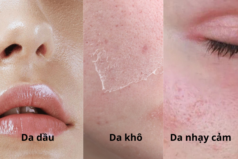 Nên tùy thuộc vào từng loại da để đưa ra tần suất tẩy da chết hợp lý