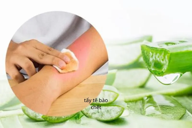 Da cháy nắng phải làm gì để hạn chế tổn thương và dễ phục hồi 3 Làm dịu da và hạn chế kích thích da