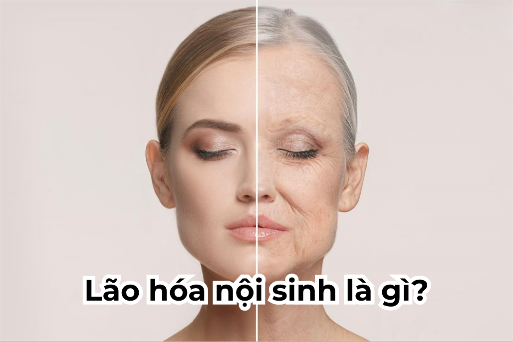 lao hoa noi sinh