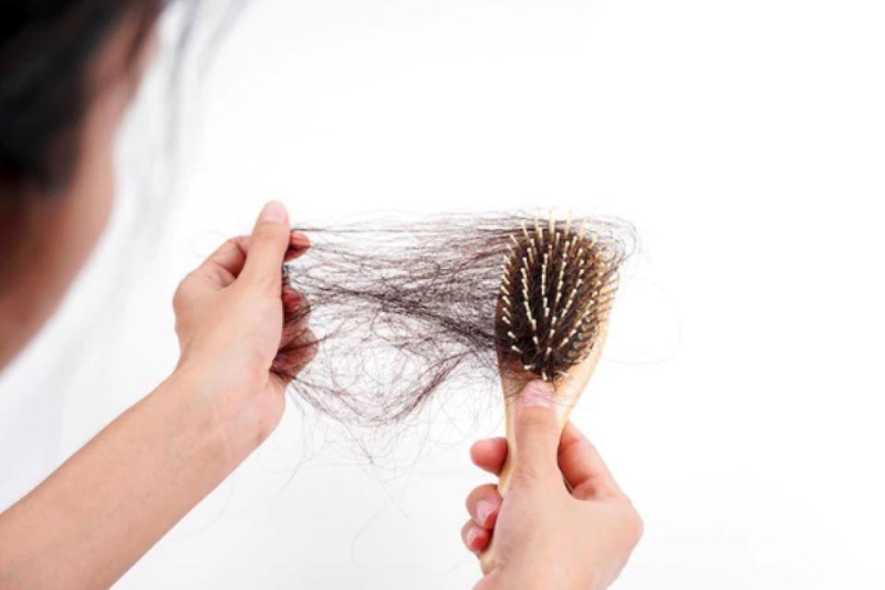 Rối loạn tuyến giáp làm tăng nguy cơ rụng tóc