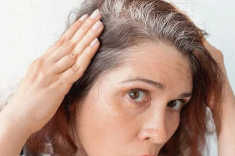 Stress cũng là một trong những nguyên nhân khiến tóc bạc sớm